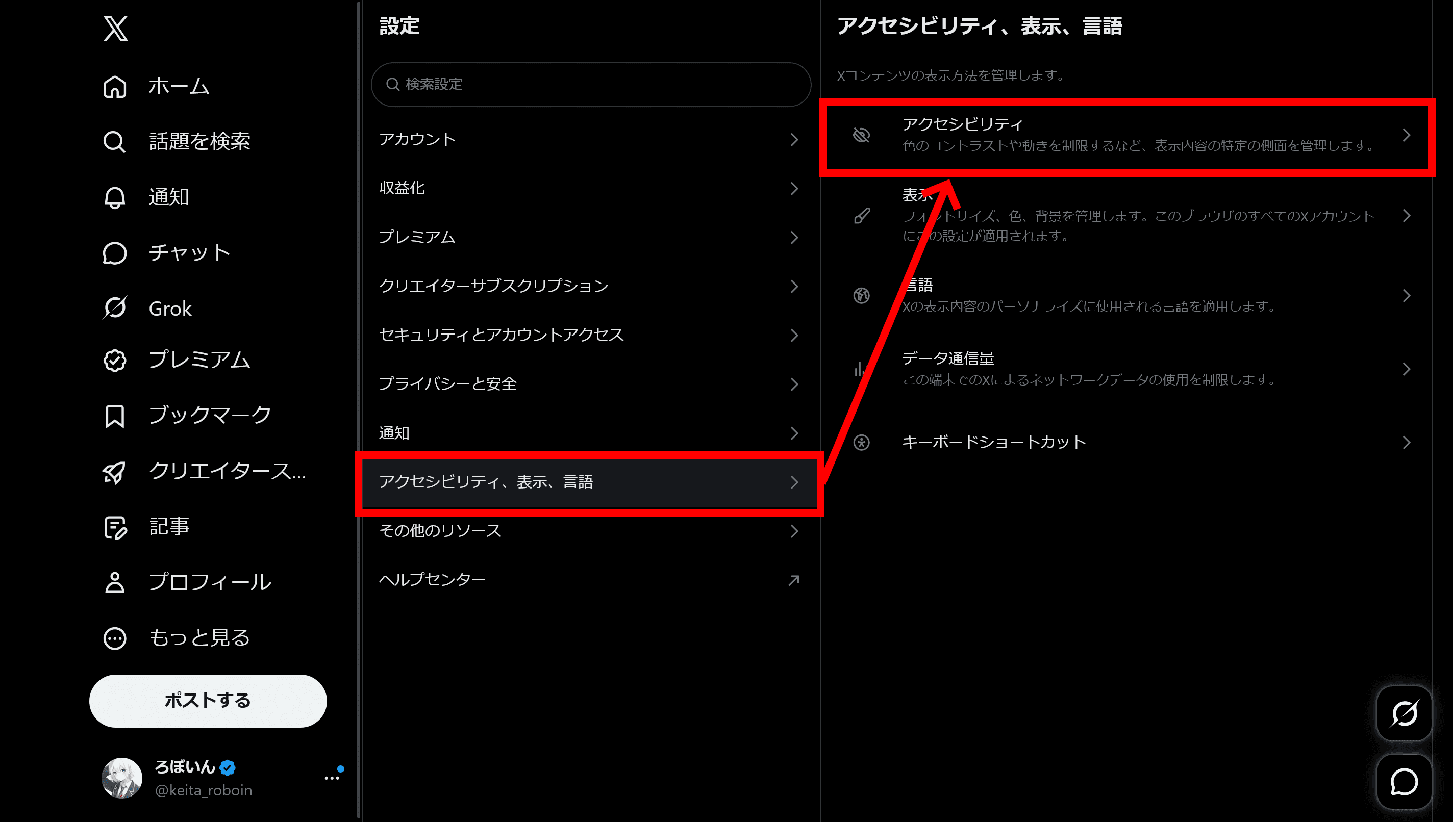 Xの［アクセシビリティ、表示、言語］>［アクセシビリティ］の設定のスクリーンショット